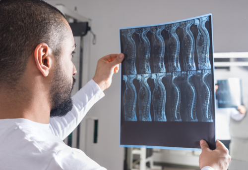 A male doctor closely examines a spinal X-ray scan in a medical imaging room, focusing on multiple views of the spine to assess potential injuries or abnormalities.