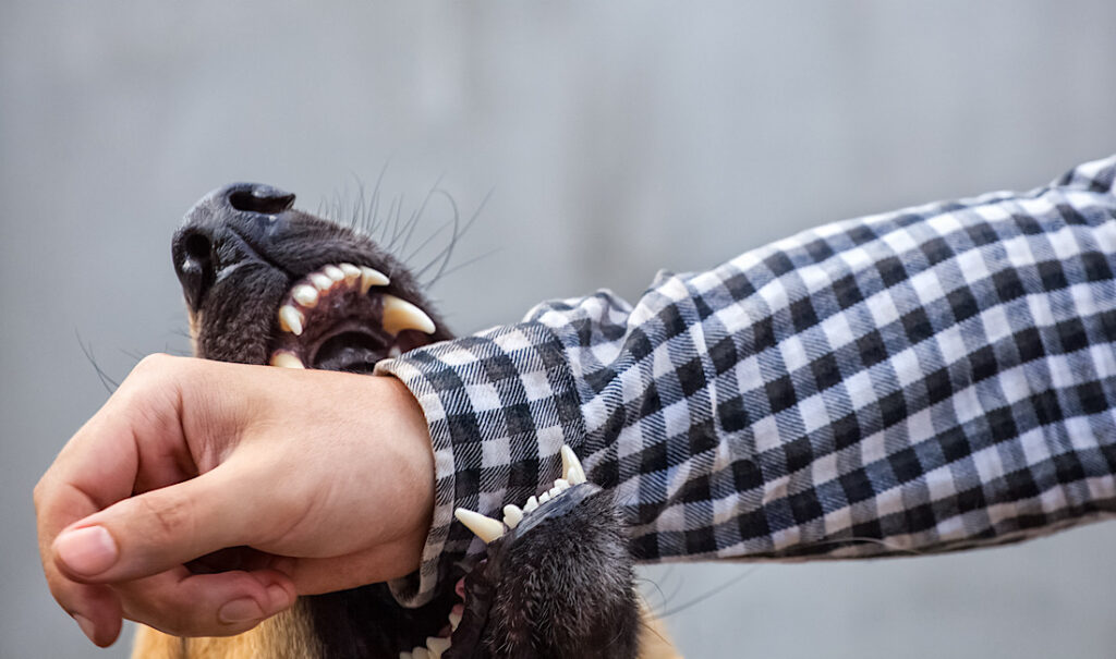 Dog bite, animal attack in Athens, GA